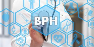 BPH Influenced by Several Factors