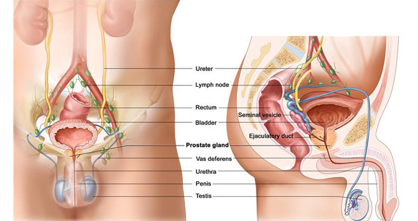 Early-Detection-Treatment-of-Prostate-Cancer