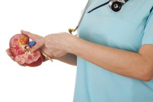 What You Need to Know About Passing Kidney Stones